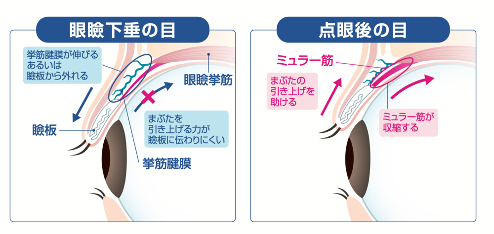 適用となる種類